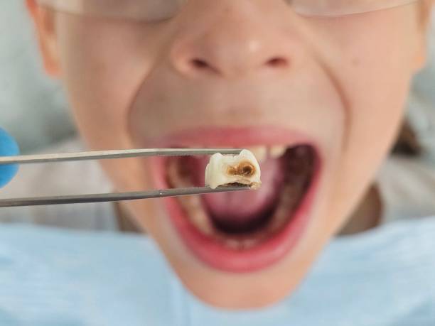 Best Tooth Pain Emergency Relief  in Live Oak, FL